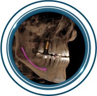 Icono tomografía Odontoimagen